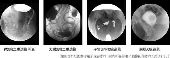 第2X-TV室写真