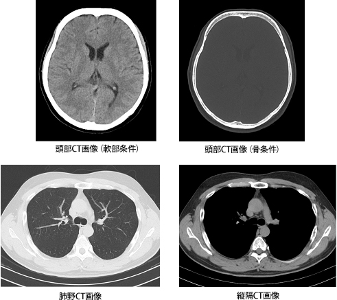CT撮影室