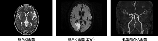 MRI撮影室