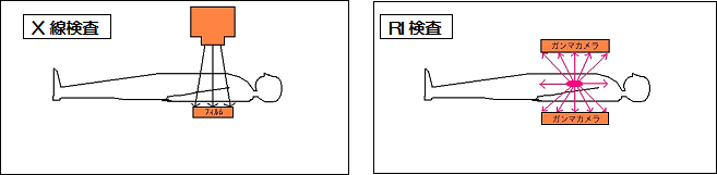 RI(核医学)撮影室
