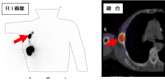 RI(核医学)撮影室