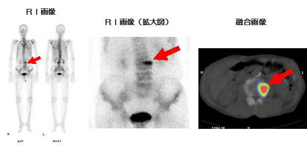 RI(核医学)撮影室